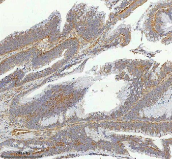 hIST1/IST1 Antibody