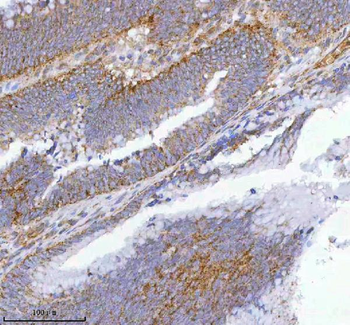 hIST1/IST1 Antibody