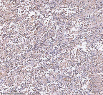 hIST1/IST1 Antibody