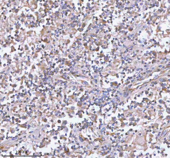 hIST1/IST1 Antibody