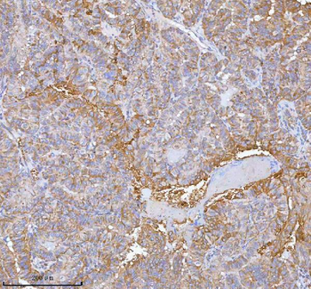hIST1/IST1 Antibody