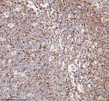 IRS4 Antibody
