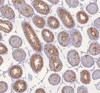 IRS4 Antibody