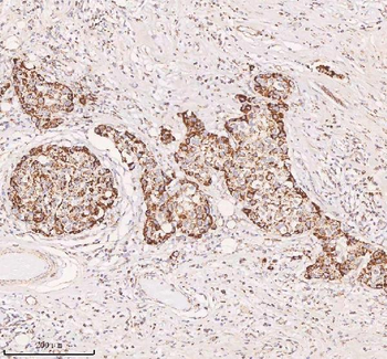 IRS4 Antibody