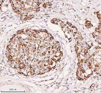 IRS4 Antibody