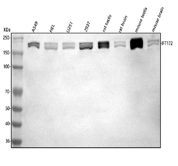 IFT172 Antibody