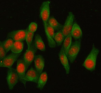 HELLS Rabbit Polyclonal Antibody