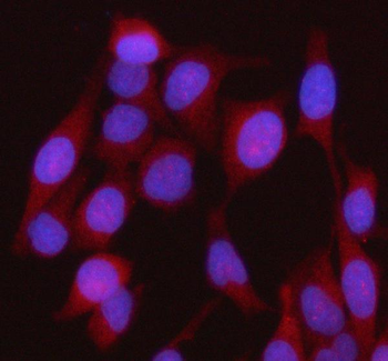 HEBP1 Rabbit Polyclonal Antibody