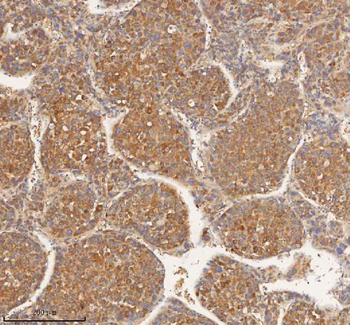 HEBP1 Rabbit Polyclonal Antibody