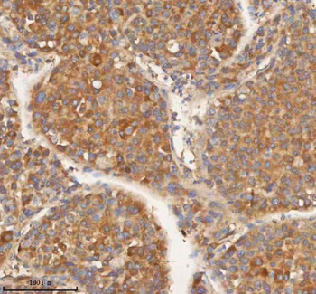 HEBP1 Rabbit Polyclonal Antibody