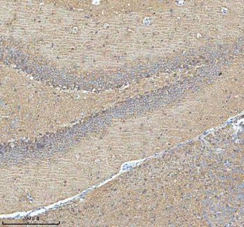 HDHD5 Antibody