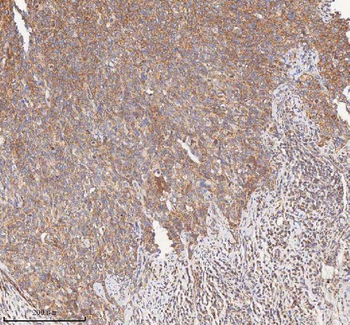 HDHD5 Antibody