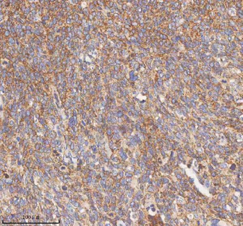 HDHD5 Antibody