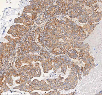 HDHD5 Antibody