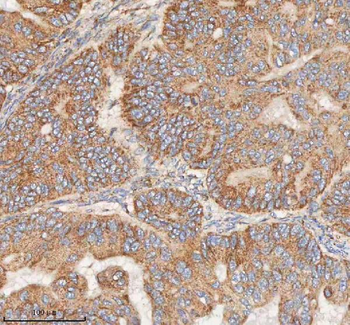 HDHD5 Antibody