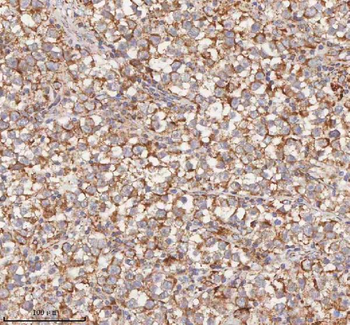 HDHD5 Antibody