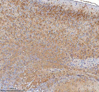 HDHD5 Antibody