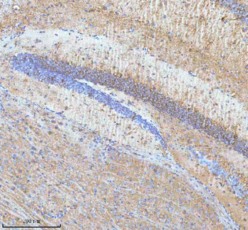HDHD5 Antibody