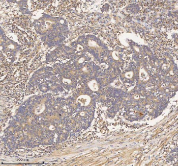 HDHD2 Antibody