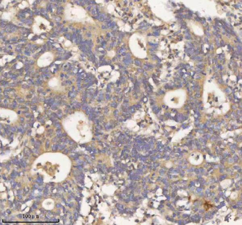 HDHD2 Antibody