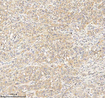 HDHD2 Antibody