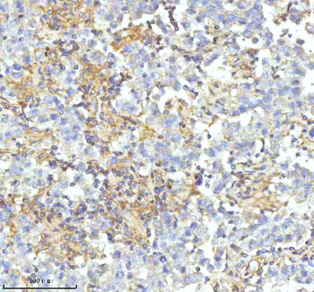 HDHD2 Antibody