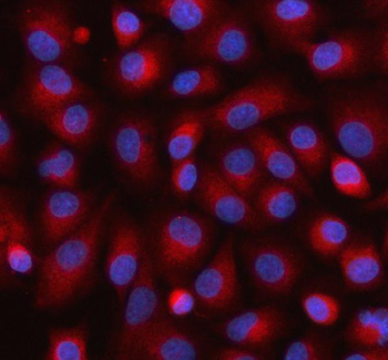 UCHL5IP/HAUS7 Rabbit Polyclonal Antibody