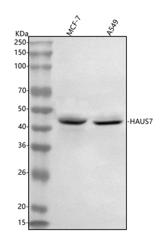 UCHL5IP/HAUS7 Rabbit Polyclonal Antibody