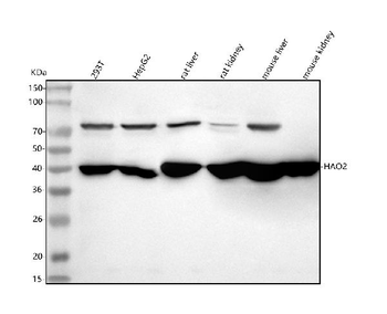 HAO2 Rabbit Polyclonal Antibody