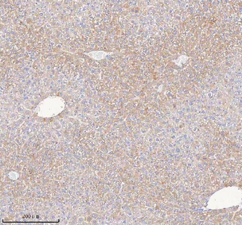HAO1 Rabbit Polyclonal Antibody