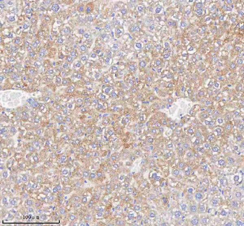 HAO1 Rabbit Polyclonal Antibody