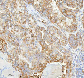 HAGH Antibody