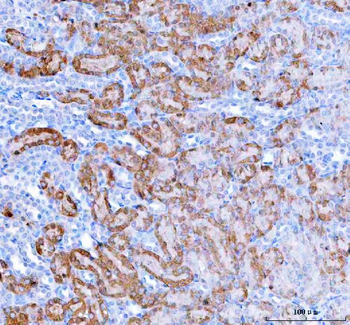 HAGH Antibody
