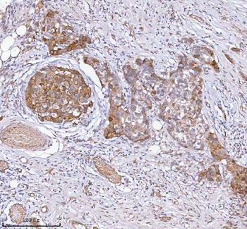 HAGH Antibody