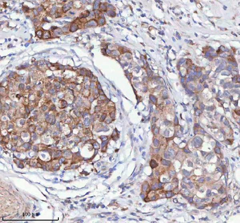 HAGH Antibody