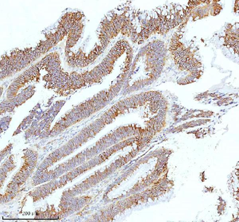 HAGH Antibody