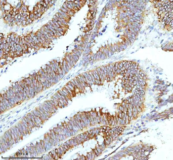 HAGH Antibody
