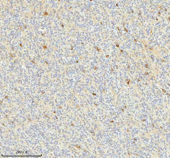 HAGH Antibody