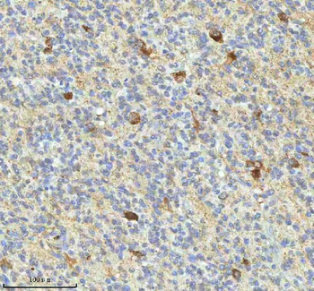 HAGH Antibody