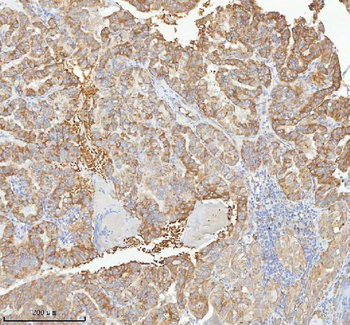 HAGH Antibody