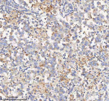 HADHB Antibody