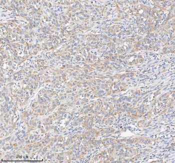 HADHB Antibody