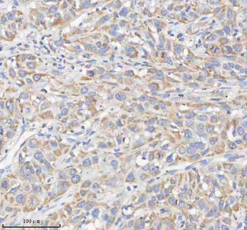 HADHB Antibody