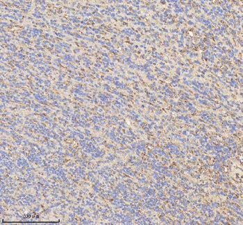 HADHB Antibody