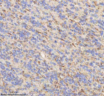 HADHB Antibody