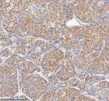 HADHB Antibody