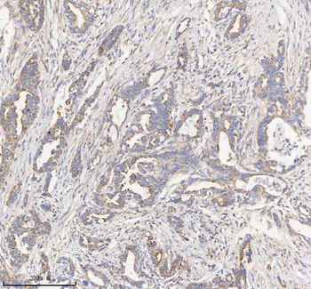 HADHB Antibody