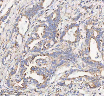 HADHB Antibody
