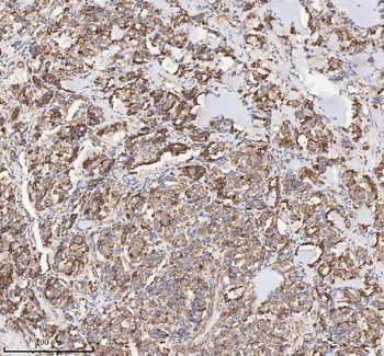 HADH Antibody