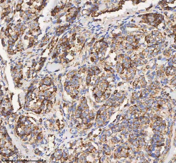HADH Antibody